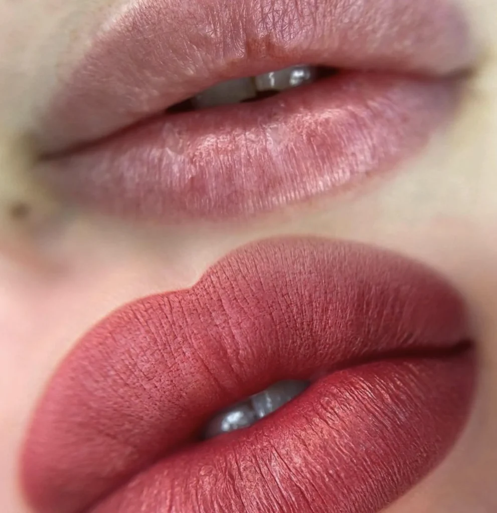 dark lip neutralization